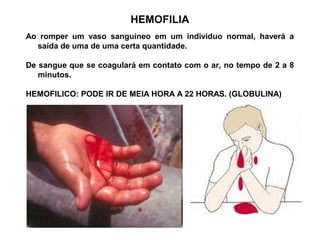 HEMOFILIA
Ao romper um vaso sanguíneo em um individuo normal, haverá a
saída de uma de uma certa quantidade.
De sangue que se coagulará em contato com o ar, no tempo de 2 a 8
minutos.
HEMOFILICO: PODE IR DE MEIA HORA A 22 HORAS. (GLOBULINA)
 