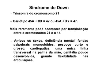 Síndrome de Down
→ Trissomia do cromossomo 21
→ Cariótipo 45A + XX = 47 ou 45A + XY = 47.
Mais raramente pode acontecer por translocação
entre o cromossomo 21 e o 14.
→ Ambos os sexos, deficiência mental, fendas
palpebrais mongolóides, pescoço curto e
grosso, cardiopatias, uma única linha
transversal na palma da mão, genitália pouco
desenvolvida, grande flexibilidade nas
articulações.
 