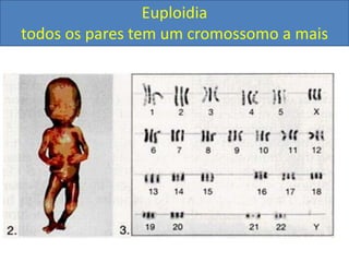 Euploidia
todos os pares tem um cromossomo a mais
 