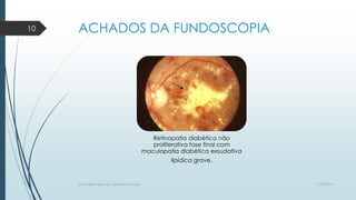 ACHADOS DA FUNDOSCOPIA
Retinopatia diabética não
proliferativa fase final com
maculopatia diabética exsudativa
lipídica grave.
7/21/2014por Anielly Meira de Lacerda Macêdo
10
 