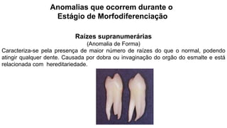 Anomalias que ocorrem durante o
Estágio de Morfodiferenciação
Raízes supranumerárias
(Anomalia de Forma)
Caracteriza-se pela presença de maior número de raízes do que o normal, podendo
atingir qualquer dente. Causada por dobra ou invaginação do orgão do esmalte e está
relacionada com hereditariedade.
 
