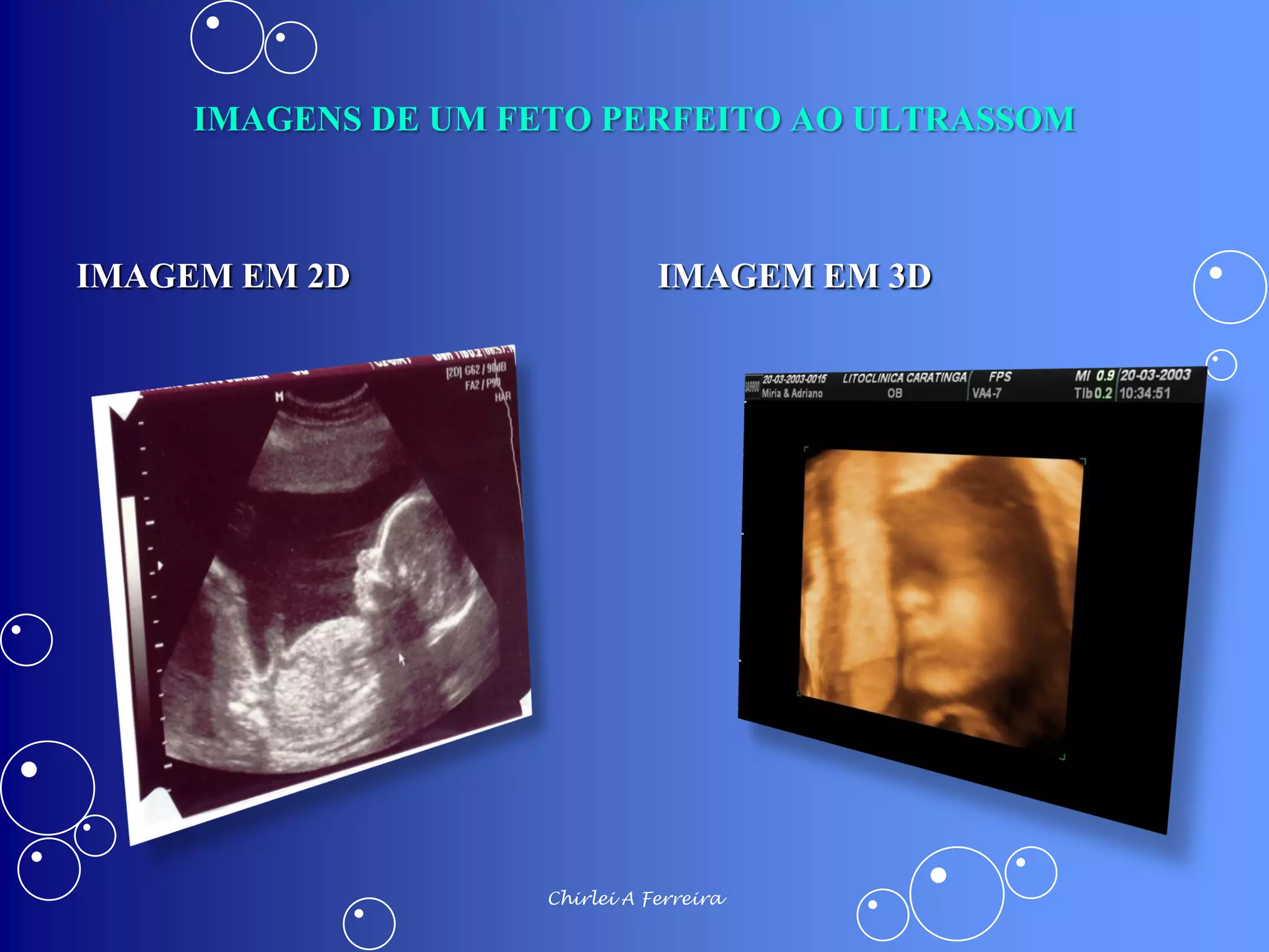 ALTERAÇÕES FISIOLÓGICAS DA GRAVIDEZ