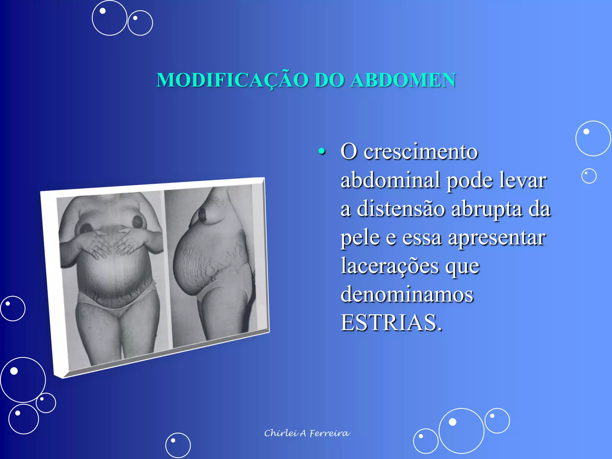 ALTERAÇÕES FISIOLÓGICAS DA GRAVIDEZ