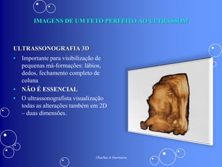 ALTERAÇÕES FISIOLÓGICAS DA GRAVIDEZ