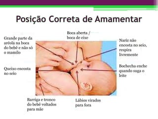 Boca aberta /
boca de eixe
Nariz não
encosta no seio,
respira
livremente
Bochecha enche
quando suga o
leite
Lábios virados
para fora
Barriga e tronco
do bebê voltados
para mãe
Queixo encosta
no seio
Grande parte da
aréola na boca
do bebê e não só
o mamilo
 