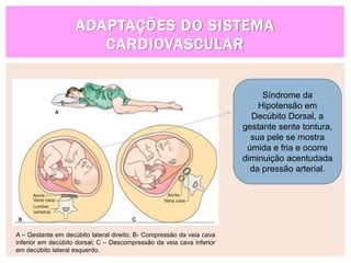 ADAPTAÇÕES DO SISTEMA
CARDIOVASCULAR
A – Gestante em decúbito lateral direito; B- Compressão da veia cava
inferior em decúbito dorsal; C – Descompressão da veia cava inferior
em decúbito lateral esquerdo.
c
Síndrome da
Hipotensão em
Decúbito Dorsal, a
gestante sente tontura,
sua pele se mostra
úmida e fria e ocorre
diminuição acentudada
da pressão arterial.
 