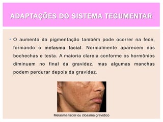 ADAPTAÇÕES DO SISTEMA TEGUMENTAR
 O aumento da pigmentação também pode ocorrer na fece,
formando o melasma facial. Normalmente aparecem nas
bochechas e testa. A maioria clareia conforme os hormônios
diminuem no final da gravidez, mas algumas manchas
podem perdurar depois da gravidez.
Melasma facial ou cloasma gravídico
 