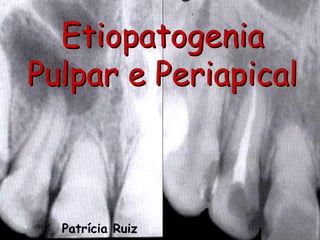 Etiopatogenia
Pulpar e Periapical
Patrícia Ruiz
 