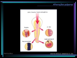 HORSTED-BINDSLEV; BERGENHOLTZ, 2006
Alterações pulpares
Patrícia Ruiz
 