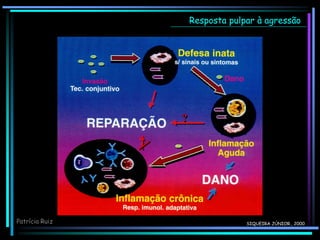 SIQUEIRA JÚNIOR., 2000
Resposta pulpar à agressão
?
Patrícia Ruiz
 