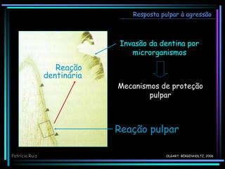 OLGART; BERGENHOLTZ, 2006
Invasão da dentina por
microrganismos
Reação pulpar
Mecanismos de proteção
pulpar
Resposta pulpar à agressão
Reação
dentinária
Patrícia Ruiz
 