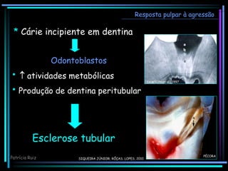 Odontoblastos
•  atividades metabólicas
• Produção de dentina peritubular
* Cárie incipiente em dentina
Esclerose tubular
CAWSON et al., 1997
Resposta pulpar à agressão
PÉCORA
Patrícia Ruiz SIQUEIRA JÚNIOR; RÔÇAS; LOPES, 2010
 