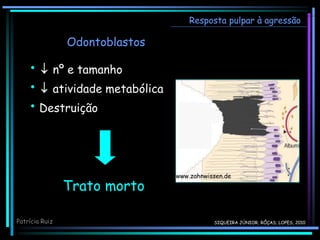 www.zahnwissen.de
•  nº e tamanho
•  atividade metabólica
• Destruição
Resposta pulpar à agressão
Odontoblastos
Trato morto
Patrícia Ruiz SIQUEIRA JÚNIOR; RÔÇAS; LOPES, 2010
 
