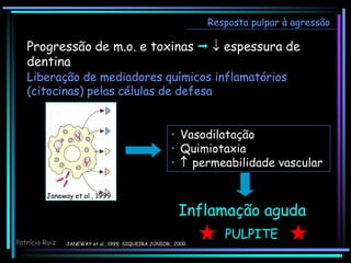 Progressão de m.o. e toxinas   espessura de
dentina
Resposta pulpar à agressão
JANEWAY et al., 1999; SIQUEIRA JÚNIOR., 2000
Patrícia Ruiz
Inflamação aguda
• Vasodilatação
• Quimiotaxia
•  permeabilidade vascular
Liberação de mediadores químicos inflamatórios
(citocinas) pelas células de defesa
Janeway et al., 1999
PULPITE
 