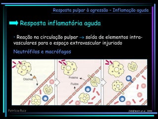 Resposta pulpar à agressão – Inflamação aguda
Resposta inflamatória aguda
JANEWAY et al., 1999
Patrícia Ruiz
• Reação na circulação pulpar  saída de elementos intra-
vasculares para o espaço extravascular injuriado
Neutrófilos e macrófagos
 