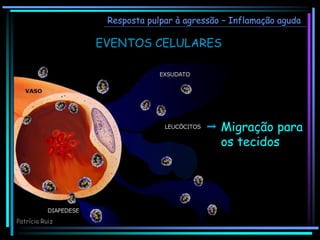  Migração para
os tecidos
Resposta pulpar à agressão – Inflamação aguda
EVENTOS CELULARES
Patrícia Ruiz
 