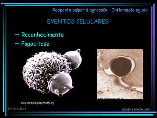 Resposta pulpar à agressão – Inflamação aguda
www.cardiologiapertutti.org
SIQUEIRA JÚNIOR., 2000
EVENTOS CELULARES
Patrícia Ruiz
 Reconhecimento
 Fagocitose
www.biologogo.com.br
 