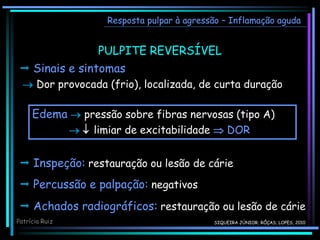 PULPITE REVERSÍVEL
Edema  pressão sobre fibras nervosas (tipo A)
  limiar de excitabilidade  DOR
Resposta pulpar à agressão – Inflamação aguda
 Sinais e sintomas
 Dor provocada (frio), localizada, de curta duração
 Inspeção: restauração ou lesão de cárie
 Percussão e palpação: negativos
 Achados radiográficos: restauração ou lesão de cárie
Patrícia Ruiz SIQUEIRA JÚNIOR; RÔÇAS; LOPES, 2010
 