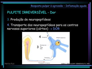 Resposta pulpar à agressão – Inflamação aguda
PULPITE IRREVERSÍVEL - Dor
3. Produção de neuropeptídeos
4. Transporte dos neuropeptídeos para os centros
nervosos superiores (córtex)  DOR
3
4
NÄRHI, 2006; OLGART; BERGENHOLTZ, 2006
Patrícia Ruiz
 