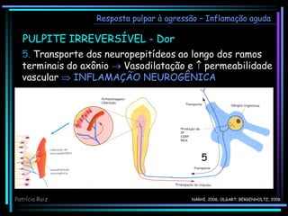 Resposta pulpar à agressão – Inflamação aguda
PULPITE IRREVERSÍVEL - Dor
5. Transporte dos neuropepitídeos ao longo dos ramos
terminais do axônio  Vasodilatação e  permeabilidade
vascular  INFLAMAÇÃO NEUROGÊNICA
5
NÄRHI, 2006; OLGART; BERGENHOLTZ, 2006
Patrícia Ruiz
 