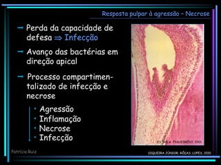  Perda da capacidade de
defesa  Infecção
 Avanço das bactérias em
direção apical
Resposta pulpar à agressão – Necrose
ESTRELA; FIGUEIREDO, 2001
• Agressão
• Inflamação
• Necrose
• Infecção
 Processo compartimen-
talizado de infecção e
necrose
Patrícia Ruiz SIQUEIRA JÚNIOR; RÔÇAS; LOPES, 2010
 