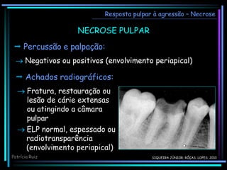 NECROSE PULPAR
 Percussão e palpação:
 Negativos ou positivos (envolvimento periapical)
 Achados radiográficos:
 Fratura, restauração ou
lesão de cárie extensas
ou atingindo a câmara
pulpar
Resposta pulpar à agressão – Necrose
 ELP normal, espessado ou
radiotransparência
(envolvimento periapical)
Patrícia Ruiz SIQUEIRA JÚNIOR; RÔÇAS; LOPES, 2010
 