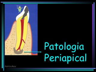 Patologia
Periapical
Patrícia Ruiz
 