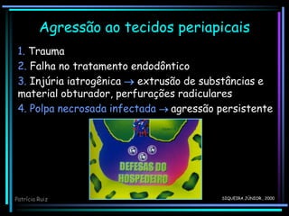 1. Trauma
2. Falha no tratamento endodôntico
3. Injúria iatrogênica  extrusão de substâncias e
material obturador, perfurações radiculares
4. Polpa necrosada infectada  agressão persistente
Agressão ao tecidos periapicais
SIQUEIRA JÚNIOR., 2000
Patrícia Ruiz
 