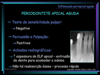 Inflamação periapical aguda
PERIODONTITE APICAL AGUDA
 Teste de sensibilidade pulpar:
 Negativo
 Percussão e Palpação:
 Positivos
 Achados radiográficos:
  espessura do ELP apical – extrusão
do dente para acomodar o edema
 Não há reabsorção óssea – processo rápido
Patrícia Ruiz SIQUEIRA JÚNIOR; RÔÇAS; LOPES, 2010
 