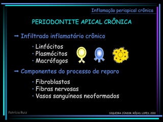 PERIODONTITE APICAL CRÔNICA
Inflamação periapical crônica
 Infiltrado inflamatório crônico
• Linfócitos
• Plasmócitos
• Macrófagos
 Componentes do processo de reparo
• Fibroblastos
• Fibras nervosas
• Vasos sanguíneos neoformados
Patrícia Ruiz SIQUEIRA JÚNIOR; RÔÇAS; LOPES, 2010
 