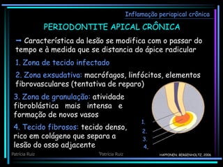 PERIODONTITE APICAL CRÔNICA
Inflamação periapical crônica
HAPPONEN; BERGENHOLTZ, 2006
1.
2.
3.
4.
 Característica da lesão se modifica com o passar do
tempo e à medida que se distancia do ápice radicular
1. Zona de tecido infectado
2. Zona exsudativa: macrófagos, linfócitos, elementos
fibrovasculares (tentativa de reparo)
3. Zona de granulação: atividade
fibroblástica mais intensa e
formação de novos vasos
4. Tecido fibrosos: tecido denso,
rico em colágeno que separa a
lesão do osso adjacente
Patrícia Ruiz Patrícia Ruiz
 