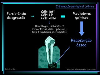 Inflamação periapical crônica
Patrícia Ruiz
Persistência
da agressão
Céls. infl.
Céls. LP
Céls. osso
Mediadores
químicos

Reabsorção
óssea
Macrófagos, Linfócitos T
Fibroblastos, Céls. Epiteliais,
Céls. Endoteliais, Osteoblstos
SIQUEIRA JÚNIOR; RÔÇAS; LOPES, 2010
 