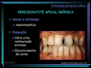  Sinais e sintomas:
 Assintomático
Inflamação periapical crônica
 Inspeção:
 Cárie e/ou
restauração
extensa
 Escurecimento
da coroa
Patrícia Ruiz
PERIODONTITE APICAL CRÔNICA
SIQUEIRA JÚNIOR; RÔÇAS; LOPES, 2010
 