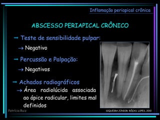 Inflamação periapical crônica
ABSCESSO PERIAPICAL CRÔNICO
 Teste de sensibilidade pulpar:
 Negativo
 Percussão e Palpação:
 Negativos
 Achados radiográficos
 Área radiolúcida associada
ao ápice radicular, limites mal
definidos
Patrícia Ruiz SIQUEIRA JÚNIOR; RÔÇAS; LOPES, 2010
 