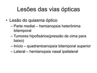 Lesões das vias ópticas 
• Lesão do quiasma óptico 
– Parte medial – hemianopsia heterônima 
bitemporal 
– Tumores hipofisários(pressão de cima para 
baixo) 
– Início – quadrantoanopsia bitemporal superior 
– Lateral – hemianopsia nasal ipsilateral 
 