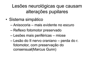 Lesões neurológicas que causam 
alterações pupilares 
• Sistema simpático 
– Anisocoria – mais evidente no escuro 
– Reflexo fotomotor preservado 
– Lesões mais periféricas – miose 
– Lesão do II nervo craniano – perda do r. 
fotomotor, com preservação do 
consensual(Marcus Gunn) 
 