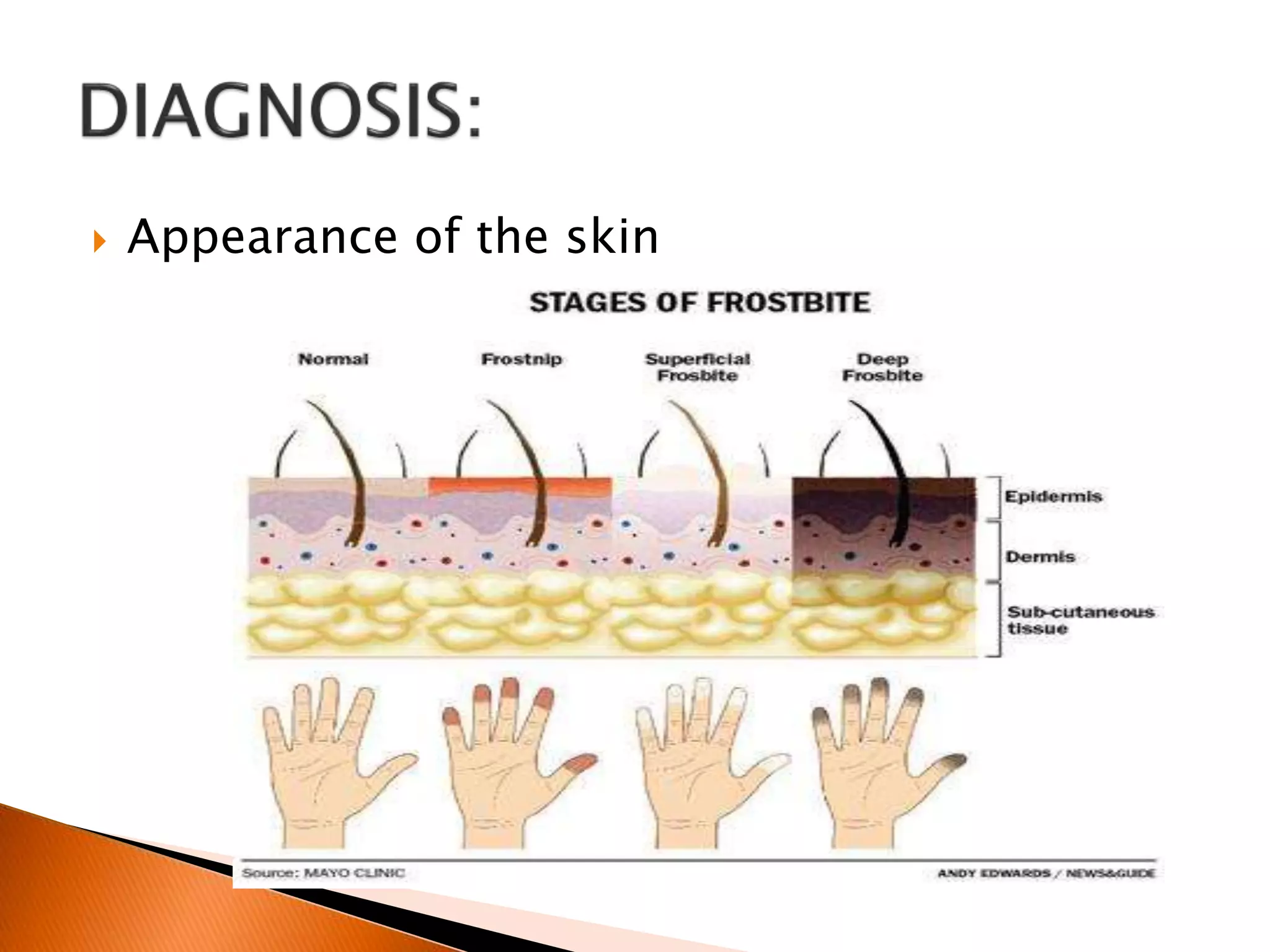 Appearance of the skin
 