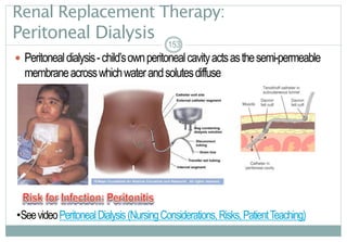 153
Renal Replacement Therapy:
Peritoneal Dialysis
 Peritonealdialysis-child’sownperitonealcavityactsasthesemi-permeable
membraneacrosswhichwaterandsolutesdiffuse
153
•SeevideoPeritonealDialysis(NursingConsiderations,Risks,PatientTeaching)
 