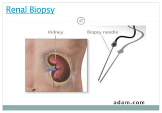 47
Renal Biopsy
4747
 