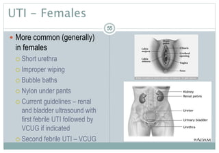 55
UTI - Females
 More common (generally)
in females
 Short urethra
 Improper wiping
 Bubble baths
 Nylon under pants
 Current guidelines – renal
and bladder ultrasound with
first febrile UTI followed by
VCUG if indicated
 Second febrile UTI – VCUG
5555
 