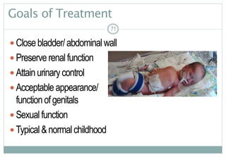 71
Goals of Treatment
 Closebladder/abdominalwall
 Preserverenalfunction
 Attainurinarycontrol
 Acceptableappearance/
functionofgenitals
 Sexualfunction
 Typical&normalchildhood
7171
 