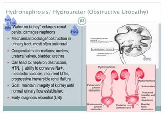 83
Hydronephrosis/ Hydroureter (Obstructive Uropathy)
 “Water on kidney” enlarges renal
pelvis, damages nephrons
 Mechanical blockage/ obstruction in
urinary tract; most often unilateral
 Congenital malformations: ureters,
ureteral valves, bladder, urethra
 Can lead to: nephron destruction,
HTN, ↓ ability to conserve Na+,
metabolic acidosis, recurrent UTIs,
progressive irreversible renal failure
 Goal: maintain integrity of kidney until
normal urinary flow established
 Early diagnosis essential (US)
8383
 
