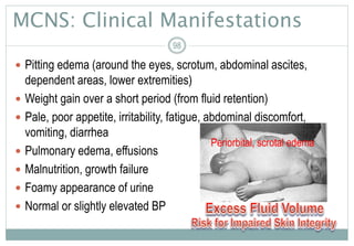 MCNS: Clinical Manifestations
 Pitting edema (around the eyes, scrotum, abdominal ascites,
dependent areas, lower extremities)
 Weight gain over a short period (from fluid retention)
 Pale, poor appetite, irritability, fatigue, abdominal discomfort,
vomiting, diarrhea
 Pulmonary edema, effusions
 Malnutrition, growth failure
 Foamy appearance of urine
 Normal or slightly elevated BP
98
Periorbital, scrotal edema
 