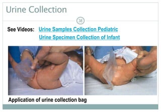 38
Urine Collection
38
Application of urine collection bag
38
See Videos: Urine Samples Collection Pediatric
Urine Specimen Collection of Infant
 