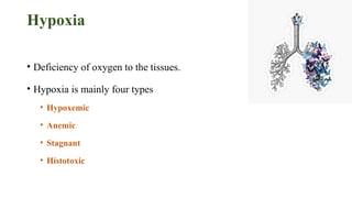 Hypoxia
• Deficiency of oxygen to the tissues.
• Hypoxia is mainly four types
• Hypoxemic
• Anemic
• Stagnant
• Histotoxic
 