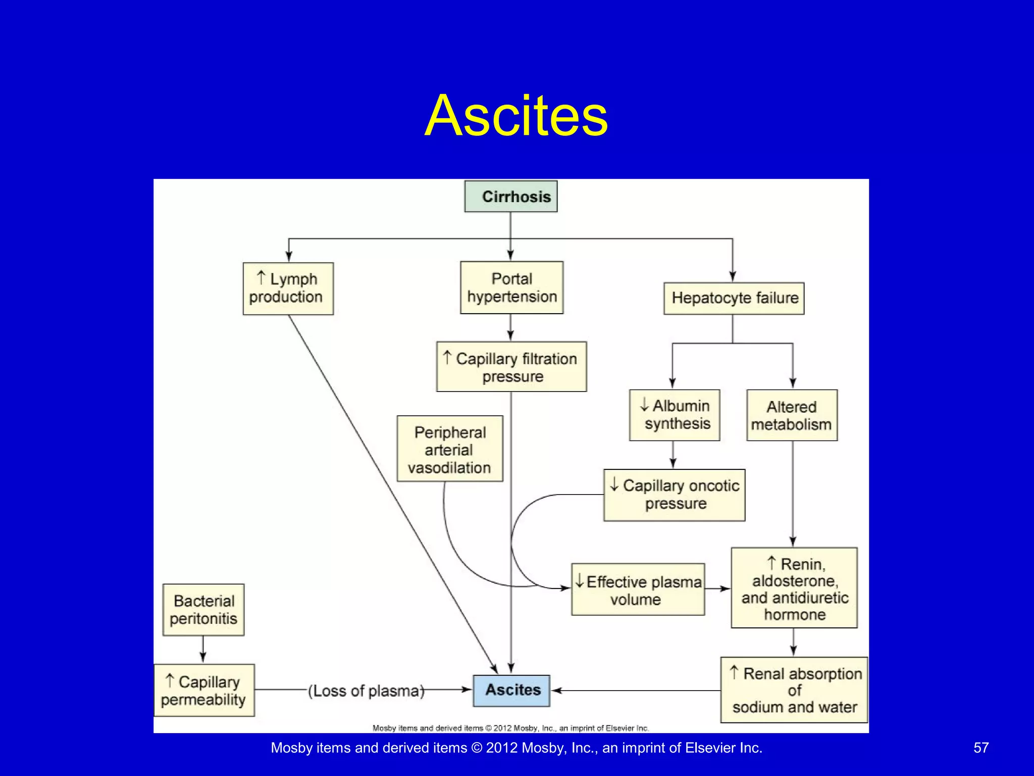 Mosby items and derived items © 2012 Mosby, Inc., an imprint of Elsevier Inc. 57
Ascites
 