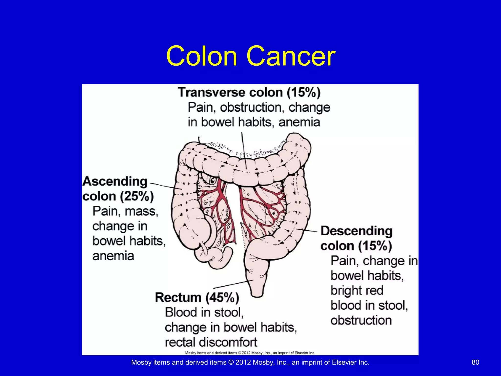 Mosby items and derived items © 2012 Mosby, Inc., an imprint of Elsevier Inc. 80
Colon Cancer
 