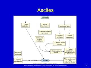 Mosby items and derived items © 2012 Mosby, Inc., an imprint of Elsevier Inc. 57
Ascites
 