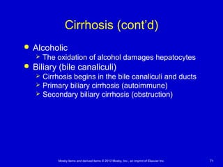 Mosby items and derived items © 2012 Mosby, Inc., an imprint of Elsevier Inc. 71
Cirrhosis (cont’d)
 Alcoholic
 The oxidation of alcohol damages hepatocytes
 Biliary (bile canaliculi)
 Cirrhosis begins in the bile canaliculi and ducts
 Primary biliary cirrhosis (autoimmune)
 Secondary biliary cirrhosis (obstruction)
 