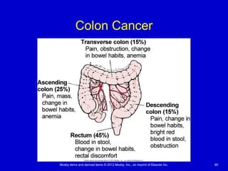Mosby items and derived items © 2012 Mosby, Inc., an imprint of Elsevier Inc. 80
Colon Cancer
 